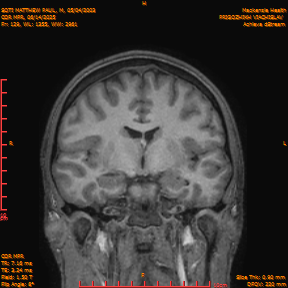 2025-06-14/COR_MPR/0130-IM475.png