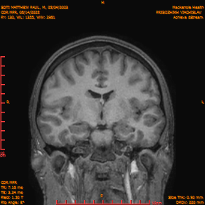 2025-06-14/COR_MPR/0131-IM476.png