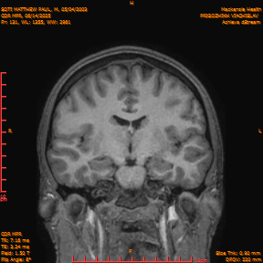 2025-06-14/COR_MPR/0132-IM477.png