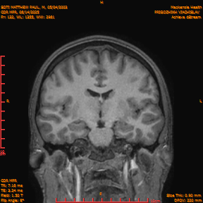 2025-06-14/COR_MPR/0133-IM478.png