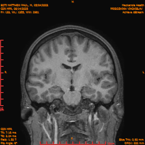 2025-06-14/COR_MPR/0134-IM479.png