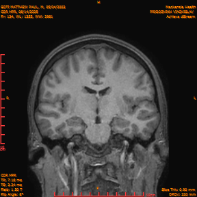 2025-06-14/COR_MPR/0135-IM480.png