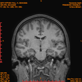 2025-06-14/COR_MPR/0136-IM481.png