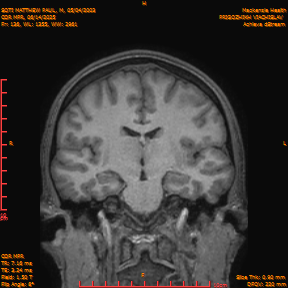2025-06-14/COR_MPR/0137-IM482.png