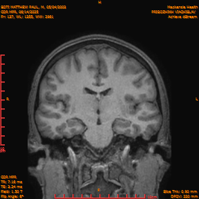 2025-06-14/COR_MPR/0138-IM483.png