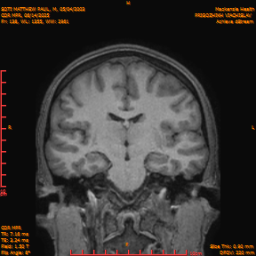 2025-06-14/COR_MPR/0139-IM484.png