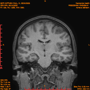 2025-06-14/COR_MPR/0140-IM485.png