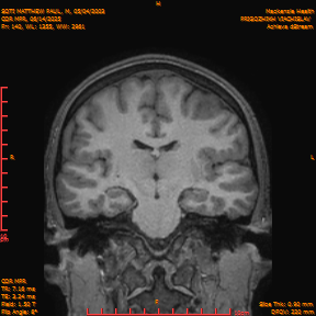 2025-06-14/COR_MPR/0141-IM486.png