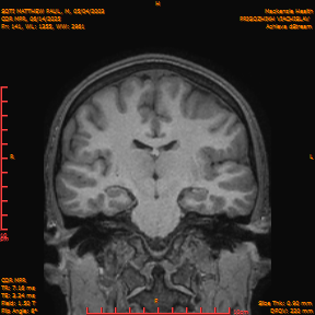 2025-06-14/COR_MPR/0142-IM487.png