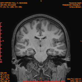 2025-06-14/COR_MPR/0143-IM488.png