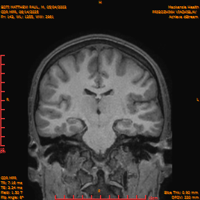 2025-06-14/COR_MPR/0144-IM489.png