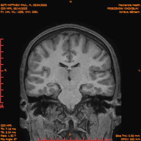2025-06-14/COR_MPR/0145-IM490.png