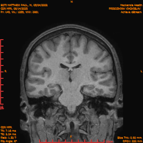2025-06-14/COR_MPR/0146-IM491.png
