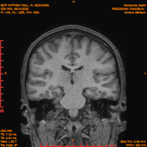 2025-06-14/COR_MPR/0147-IM492.png