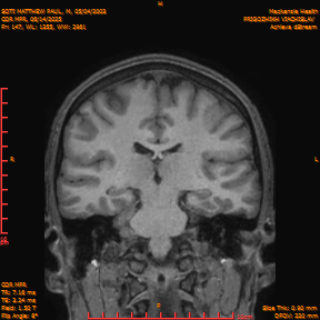 2025-06-14/COR_MPR/0148-IM493.png