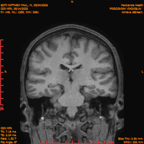 2025-06-14/COR_MPR/0149-IM494.png