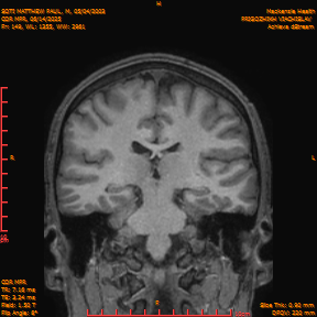 2025-06-14/COR_MPR/0150-IM495.png