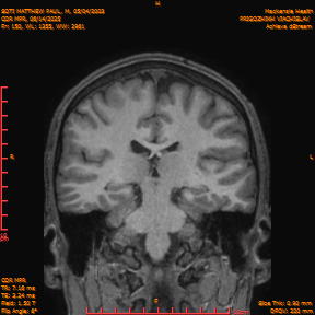 2025-06-14/COR_MPR/0151-IM496.png