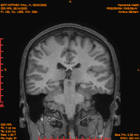 2025-06-14/COR_MPR/0154-IM499.png