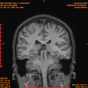 2025-06-14/COR_MPR/0157-IM502.png