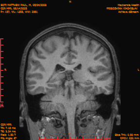 2025-06-14/COR_MPR/0158-IM503.png