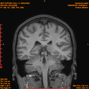 2025-06-14/COR_MPR/0159-IM504.png