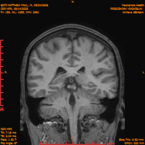 2025-06-14/COR_MPR/0160-IM505.png