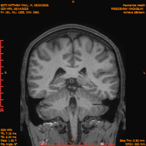 2025-06-14/COR_MPR/0162-IM507.png