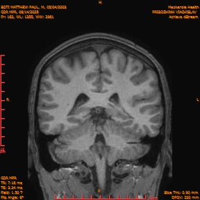 2025-06-14/COR_MPR/0163-IM508.png