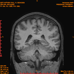 2025-06-14/COR_MPR/0165-IM510.png