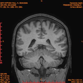 2025-06-14/COR_MPR/0166-IM511.png