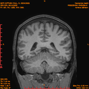 2025-06-14/COR_MPR/0168-IM513.png