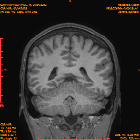 2025-06-14/COR_MPR/0169-IM514.png
