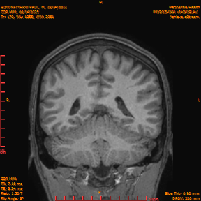 2025-06-14/COR_MPR/0171-IM516.png