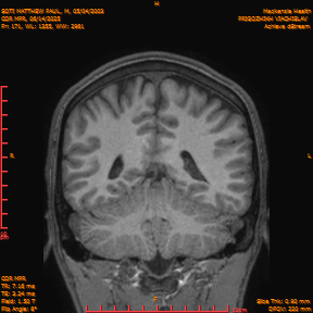 2025-06-14/COR_MPR/0172-IM517.png