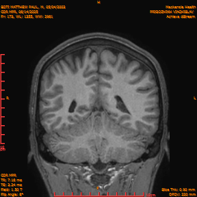 2025-06-14/COR_MPR/0174-IM519.png