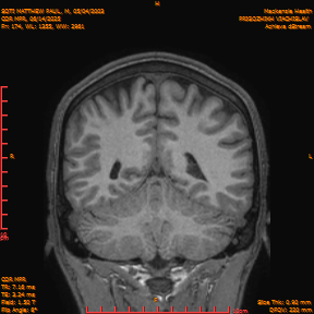 2025-06-14/COR_MPR/0175-IM520.png