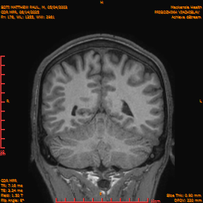 2025-06-14/COR_MPR/0177-IM522.png