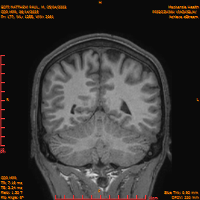 2025-06-14/COR_MPR/0178-IM523.png