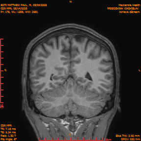 2025-06-14/COR_MPR/0179-IM524.png