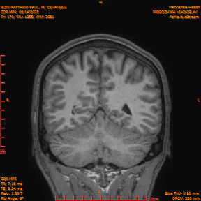 2025-06-14/COR_MPR/0180-IM525.png