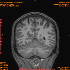 2025-06-14/COR_MPR/0183-IM528.png