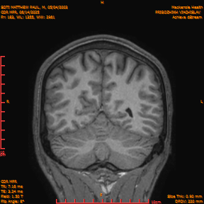 2025-06-14/COR_MPR/0184-IM529.png