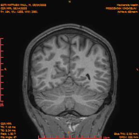 2025-06-14/COR_MPR/0185-IM530.png