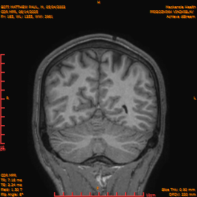2025-06-14/COR_MPR/0186-IM531.png