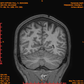 2025-06-14/COR_MPR/0187-IM532.png