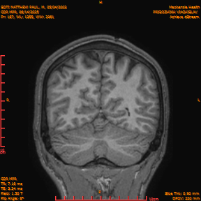 2025-06-14/COR_MPR/0188-IM533.png