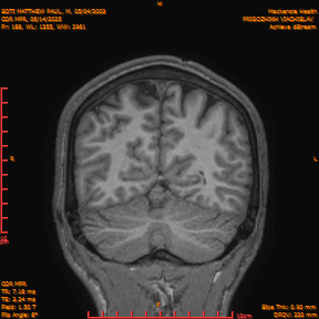 2025-06-14/COR_MPR/0189-IM534.png