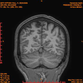2025-06-14/COR_MPR/0190-IM535.png