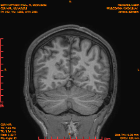 2025-06-14/COR_MPR/0191-IM536.png